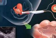 长沙试管试管最火热医院排名分享，附试管怀孕条件分析