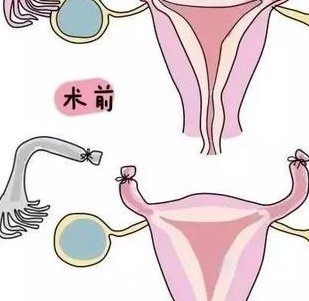 全面了解：泰国试管婴儿，你需要具备哪些条件？