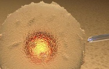 重庆试管婴儿费用揭秘：你需要了解的真实支出